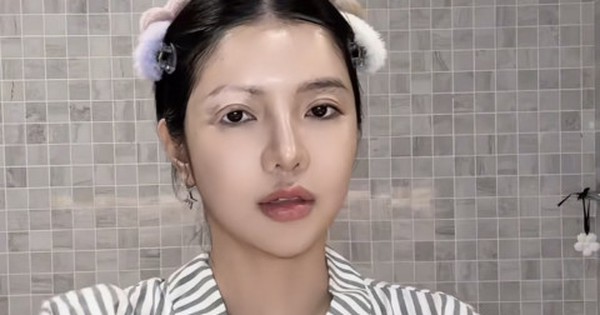 Mỹ nhân Việt mắc bệnh hiếm chỉ 2% dân số thế giới gặp phải