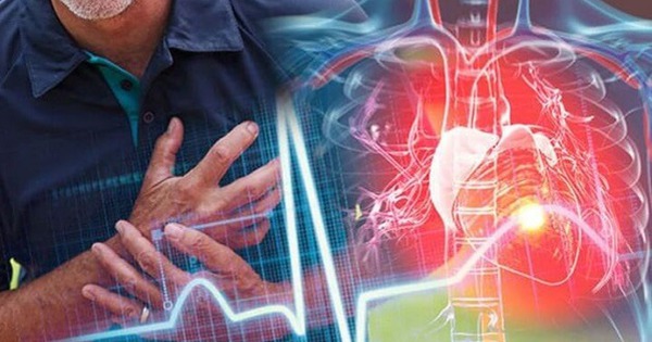 Nhóm tuổi có thể bị nhồi máu cơ tim, đột quỵ cao gấp 5 lần so với tuổi 50: Bác sĩ BV Bạch Mai cảnh báo