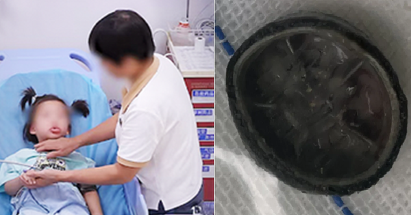 Bé gái 6 tuổi chảy máu vùng kín suốt 4 năm, đi khám mới phát hiện thứ “không ai ngờ” bên trong