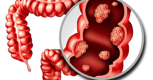 6 dấu hiệu cảnh báo đỏ của 