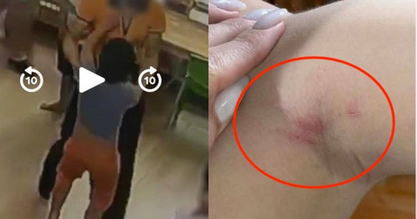 TikToker Thu Nhi Eat Clean chia sẻ sự việc cháu trai bị 