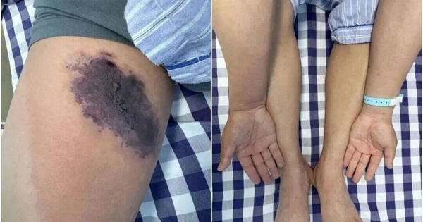 Mặc chiếc quần cũ, người đàn ông suýt 