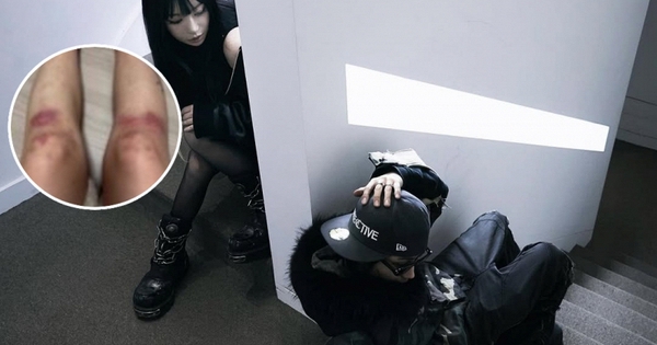 Nữ ca sĩ yêu lại bạn trai cũ từng đánh cô bầm dập toàn thân: “Tôi không kiện anh ấy nữa”