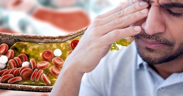 Nhìn vào mặt cũng có thể biết mỡ máu cao hay không: Nếu thấy 2 dấu hiệu này, hãy đi khám ngay