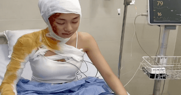 Phát hoảng với hình ảnh của 
