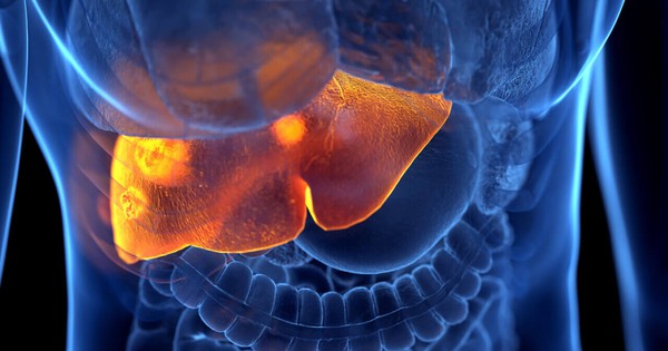 7 dấu hiệu cho thấy gan đang suy hỏng: Có 1 cũng là cảnh báo đỏ