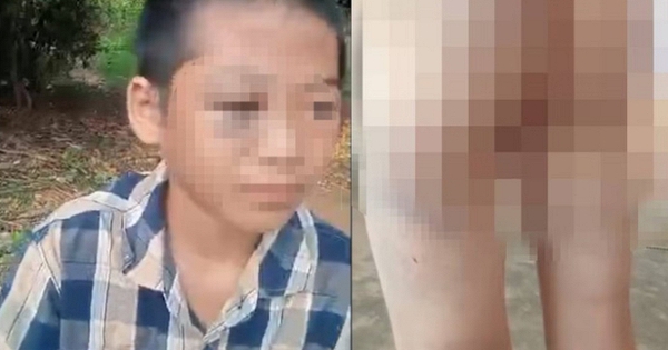 Chi tiết cực đắt trong vụ bé lớp 6 nghi bị mẹ kế và cha bạo hành: Chúng ta cần nhìn lại để dạy con mình!
