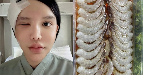 Người phụ nữ bị ký sinh trùng bò vào hốc mắt, suýt mù, bác sĩ cảnh báo 1 thói quen nhiều người Việt mắc phải