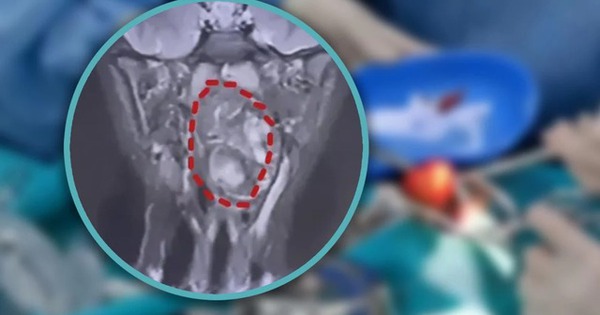 Bé trai 6 tuổi phát hiện 