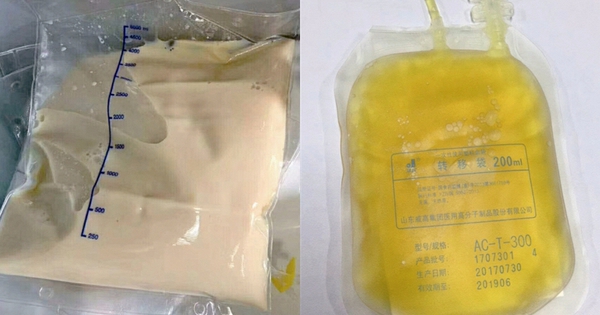 Cô gái 27 tuổi máu đục như trà sữa và 