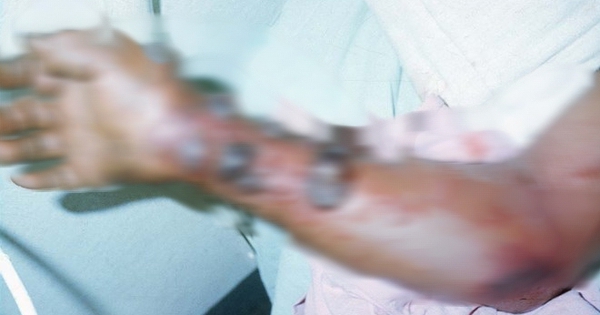 Vì sao WHO đánh giá nguy cơ Ebola vào Việt Nam ở mức thấp?