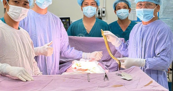 Lươn dài 50cm chọc thủng trực tràng, nằm ngoe nguẩy trong ổ bụng bệnh nhân