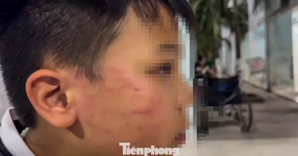 Tin mới vụ giáo viên người nước ngoài tát vào mặt học sinh