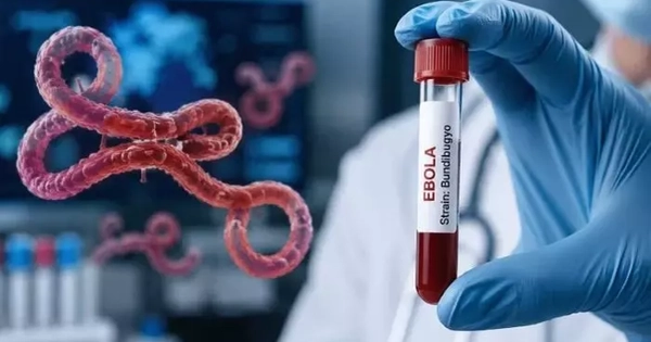 Bộ Y tế kích hoạt giám sát dich Ebola, tăng cường ngăn dịch xâm nhập