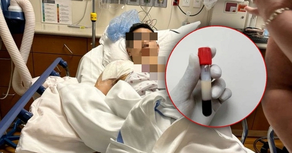 Người đàn ông 28 tuổi máu ngập mỡ, nhớt như dầu: Tất cả tại 2 món khoái khẩu và 2 loại nước 