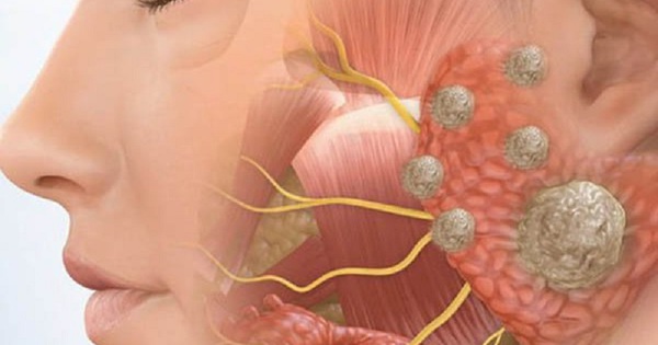 Có 1 dấu hiệu bất thường ở mặt, đi khám phát hiện hàng loạt vấn đề ở phổi, gan, thận, dạ dày