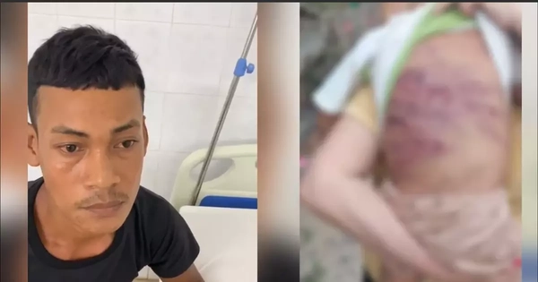 Lời khai của gã cha dượng trong vụ bé trai 2 tuổi bị bạo hành đến nguy kịch