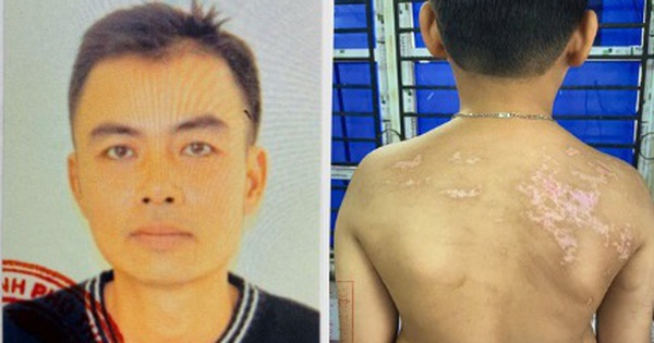 Thi hành Lệnh bắt tạm giam Nguyễn Hà Chung, nạn nhân là con ruột mới hơn 7 tuổi