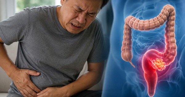 Bác sĩ cảnh báo: 4 DẤU HIỆU sớm của ung thư trực tràng, nhiều người nhầm với đau, chướng bụng bình thường