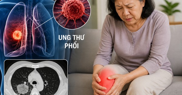 Bác sĩ cảnh báo: 3 DẤU HIỆU quan trọng của ung thư phổi, nhiều người chủ quan vì nghĩ đau chân do thời tiết