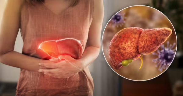 Gan đang “kêu cứu” nhưng nhiều người không biết: Bác sĩ chỉ ra 5 dấu hiệu cảnh báo sớm