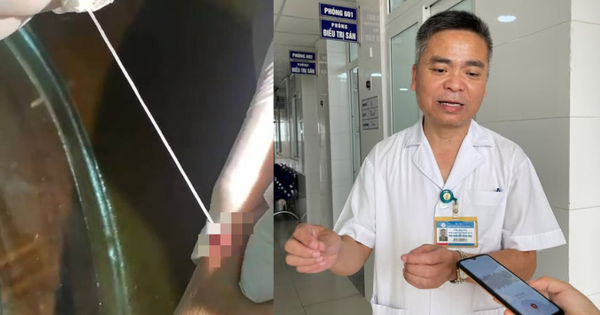 Phát hiện ca giun rồng thứ 44 tại Việt Nam: Người đàn ông ở Lào Cai có vết "mụn" ở cánh tay, nặn ra 2 đoạn giun dài tới 20cm