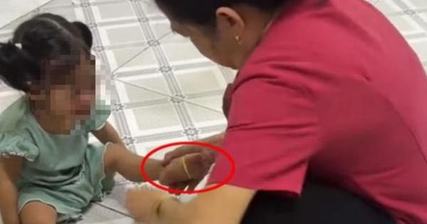 Vụ "cô giáo mầm non" liên tục bắn dây chun vào chân bé gái: Khi niềm tin của người mẹ bị gặm nhấm bởi những con sâu mọt