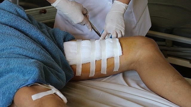 Bình rượu 20 lít phát nổ, người đàn ông bị đứt cơ chân