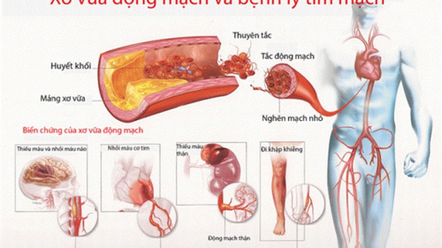 Một số chứng bệnh tim nguy hiểm thường gặp