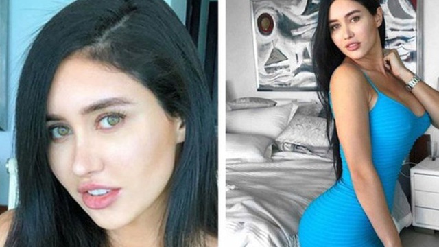 Hot girl Instagram 13 triệu follow, được mệnh danh là “em gái Kim Kardashian” qua đời vì phẫu thuật nâng mông