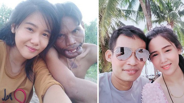Chàng trai "mặt quỷ" nên duyên, thề non hẹn biển với người vợ xinh đẹp giờ có cuộc sống ra sao sau 2 năm?
