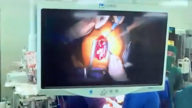 Quảng Ninh: Bệnh nhân trong vùng phong toả bị vỡ tim, được cứu sống qua hội chẩn trực tuyến