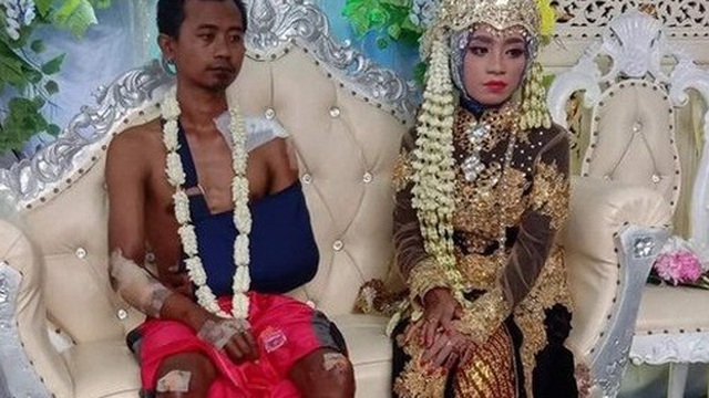 Bức ảnh chú rể mặt buồn thiu, toàn thân đầy thương tích tại đám cưới gây bão MXH, câu chuyện phía sau khiến ai cũng xúc động