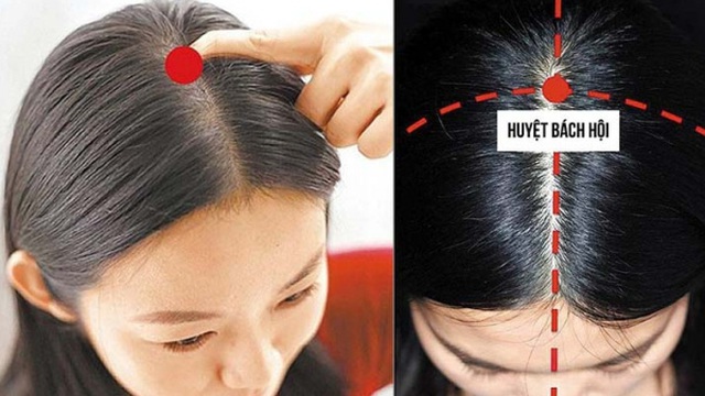 Bài thuốc trị thiếu máu não