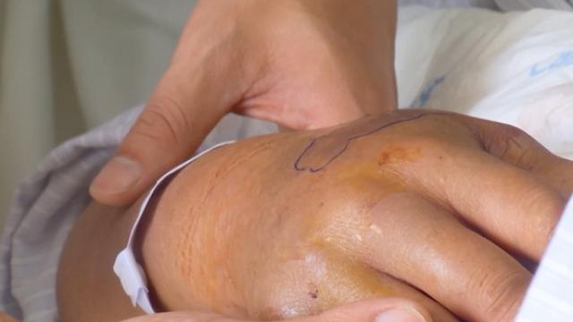 Đi chăn bò, một học sinh bị rắn cắn tử vong