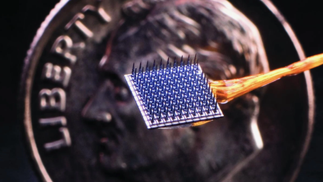 Thử nghiệm thành công chip gắn não có thể nhận biết và làm giảm cơn đau trong tích tắc