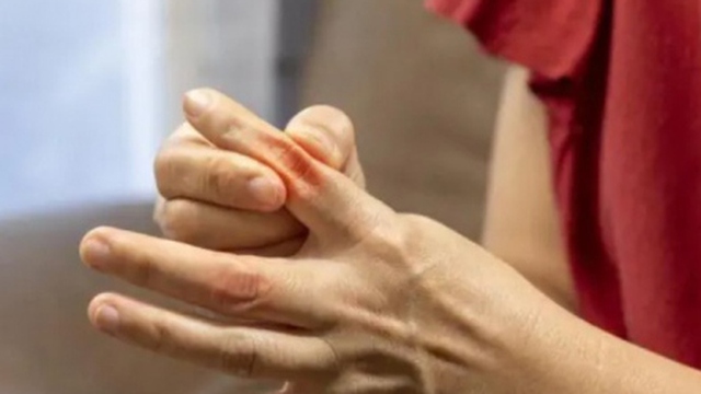 Cách kiểm soát nồng độ axit uric trong cơ thể