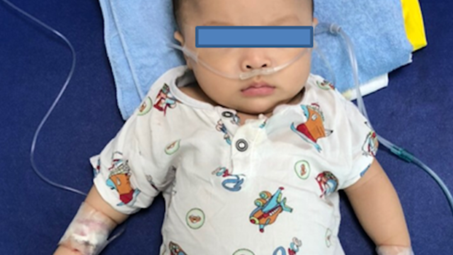 Vì nhiễm COVID-19, bệnh nhi mắc bệnh hiếm gặp của thế giới