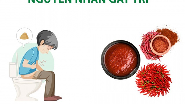 Cách phòng tránh bệnh trĩ ở nam giới tuổi trung niên