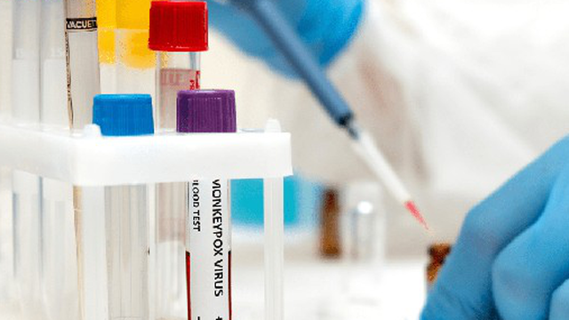 Thêm nước Đông Nam Á có đậu mùa khỉ, WHO nghi Ebola tái xuất