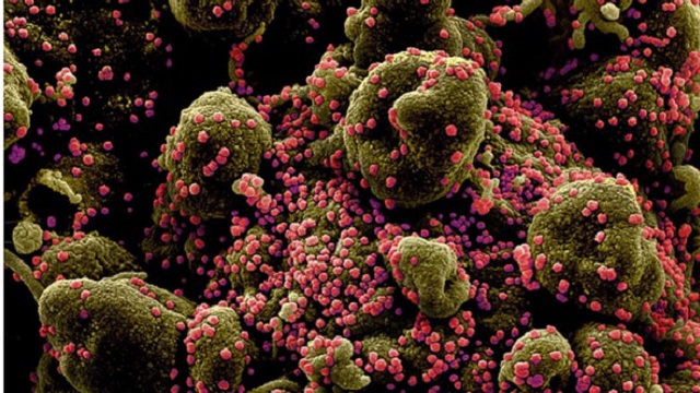 Phát hiện sinh vật đầu tiên trên thế giới chỉ ăn virus để sống