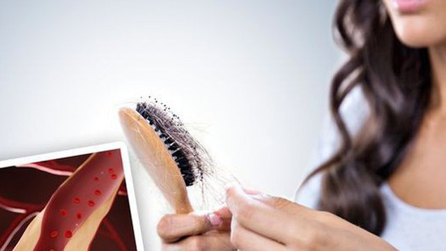 Dấu hiệu này trên tóc tưởng bình thường nhưng lại có thể là báo động đỏ tình trạng cholesterol cao