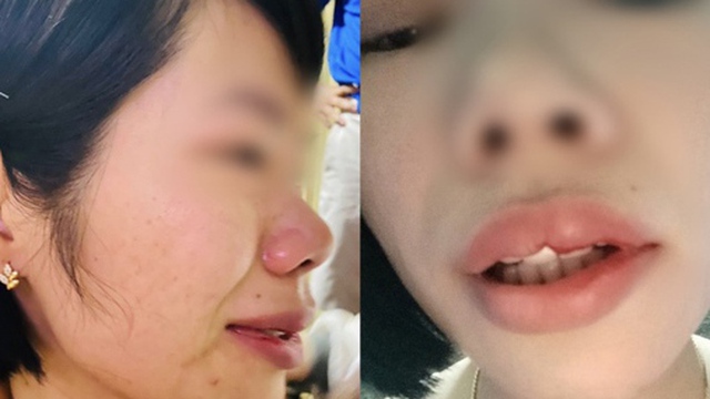 Con bị hạnh kiểm trung bình, thầy giáo hành hung đồng nghiệp: Thông tin mới nhất