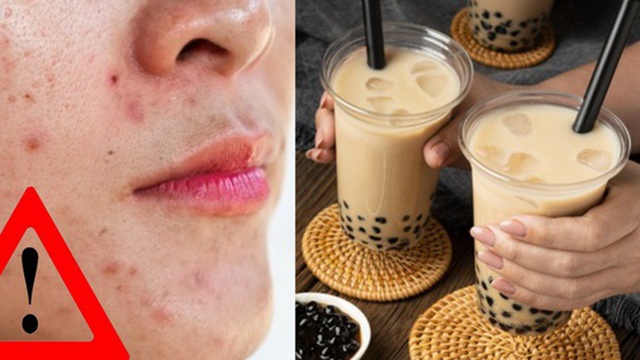 WHO cảnh báo: 3 thực phẩm khiến bạn già đi trông thấy