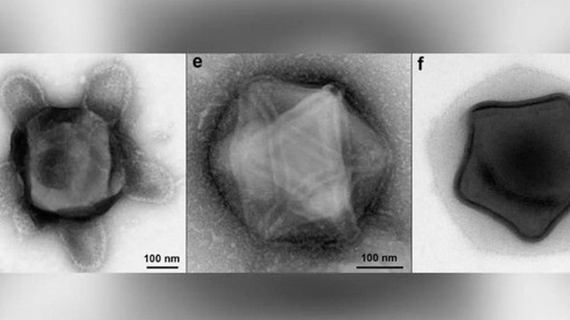 Phát hiện mầm bệnh kinh dị nhất: Virus có xúc tu bạch tuộc