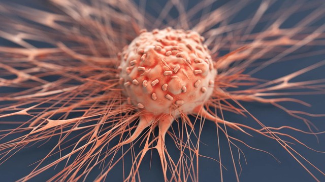 6 điều khiến khối u "khiếp sợ", làm đủ chẳng lo ung thư "ghé thăm"