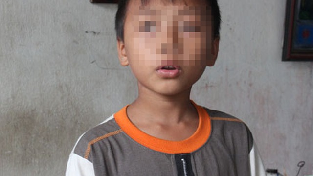 Nghi án bé 10 tuổi bị bắt cóc để bán nội tạng