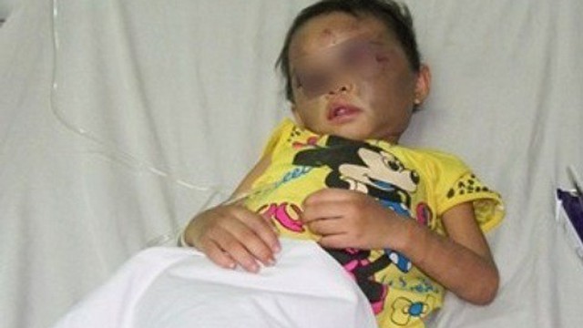 Bé gái 4 tuổi bị đánh dã man: "Sao con khổ thế này hả Ngân"