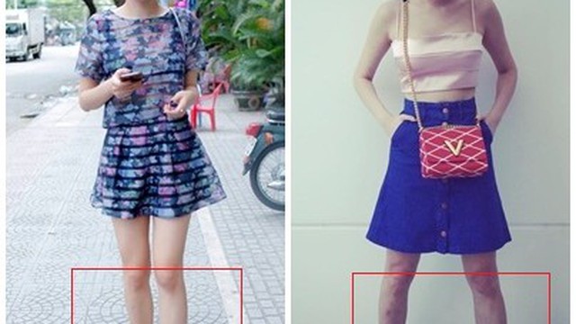 Tóc Tiên gây thất vọng với đôi chân "xấu xí"