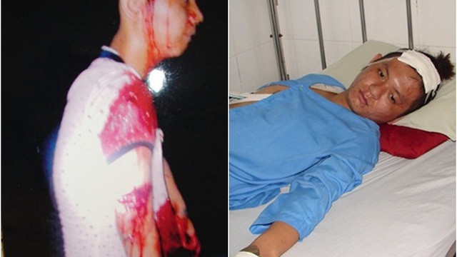 Côn đồ cầm mã tấu lao vào nhà, chém xối xả nam thanh niên